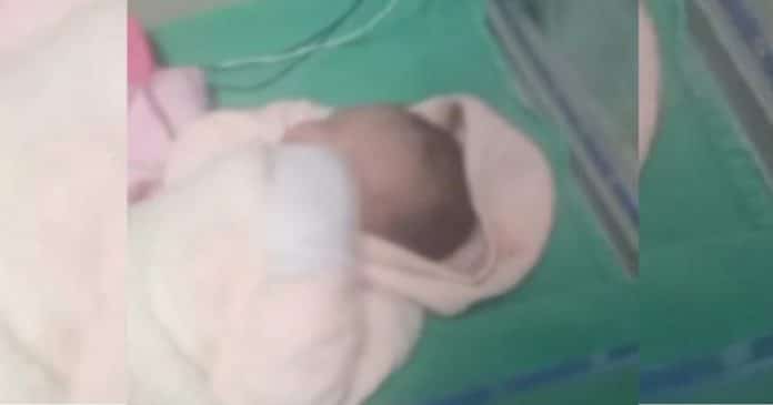 Bebê que teve a cabeça cortada no parto pode ter sequela neurológica permanente