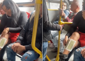 Mulher viraliza ao se depilar com cera em ônibus: ‘Nojento’