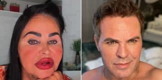 Mãe de Eduardo Costa nega ter feito harmonização facial e rebate críticas Mãe de Eduardo Costa nega ter feito harmonização facial e rebate críticas