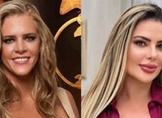 Denise Rocha viraliza na web ao surgir irreconhecível após vários procedimento: “Outra pessoa”