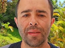 Motorista que atropelou Kayky Brito faz harmonização facial e resultado surpreende