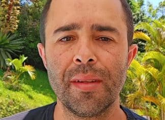 Motorista que atropelou Kayky Brito faz harmonização facial e resultado surpreende