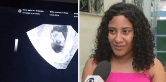 Jovem de 18 anos passa mal ao descobrir gravidez de quíntuplos: “Falta de ar”