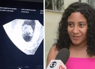 Jovem de 18 anos passa mal ao descobrir gravidez de quíntuplos: “Falta de ar”