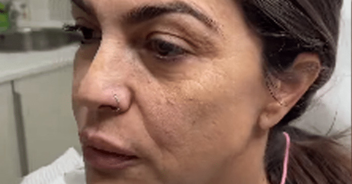 Mulher impressiona com antes e depois de harmonização facial: “Vai ter que tirar nova identidade”