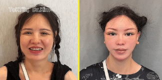 Médico é detonado nas redes sociais ao exibir antes e depois de suas cirurgias plásticas