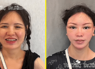 Médico é detonado nas redes sociais ao exibir antes e depois de suas cirurgias plásticas