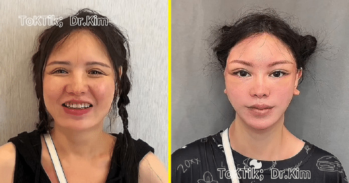 Médico é detonado nas redes sociais ao exibir antes e depois de suas cirurgias plásticas