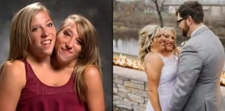 Como é a vida das gêmeas simesas que acabaram de se casar com enfermeiro nos EUA