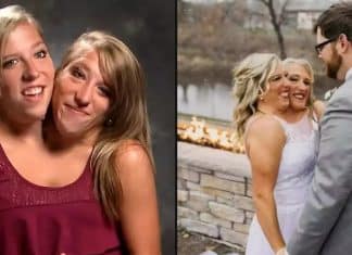 Como é a vida das gêmeas simesas que acabaram de se casar com enfermeiro nos EUA