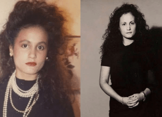Antes e Depois! Mulher passa 40 anos sem sorrir para evitar rugas