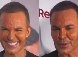 Verdade sobre a magreza extrema de Eduardo Costa deixa fãs em choque