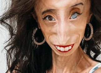 Mulher considerada a mais feia do mundo dá a volta por cima e vira palestrante motivacional