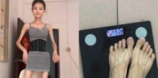 Influenciadora que pesa apenas 25 kg viraliza na web com corpo esquelético Influenciadora que pesa apenas 25 kg viraliza na web com corpo esquelético