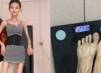 Influenciadora que pesa apenas 25 kg viraliza na web com corpo esquelético