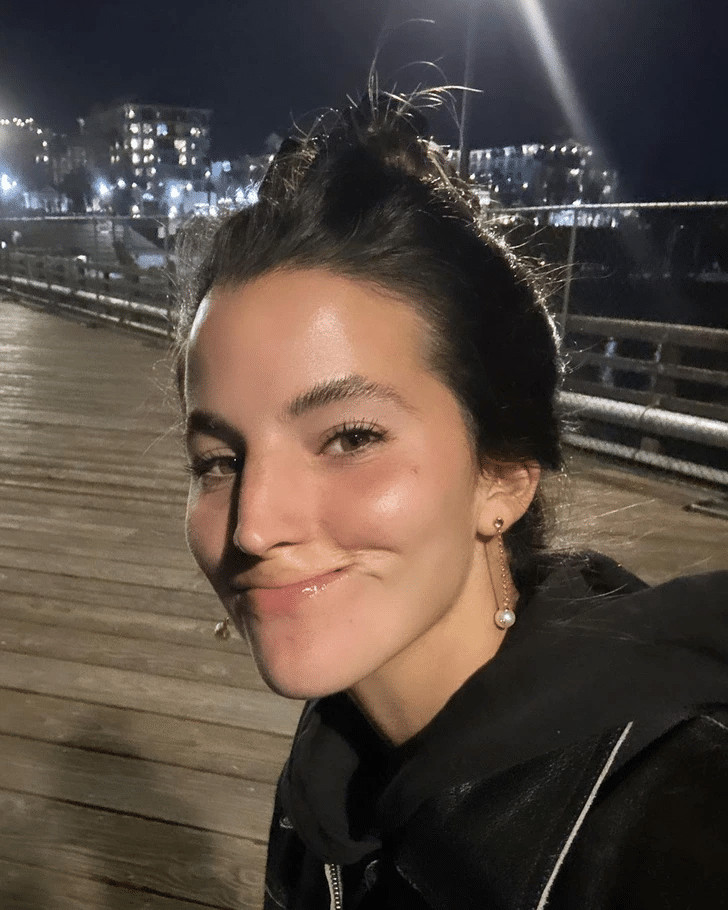contioutra.com - Jovem que perdeu os l&aacute;bios ap&oacute;s ataque de pitbull compartilha sua jornada de recupera&ccedil;&atilde;o