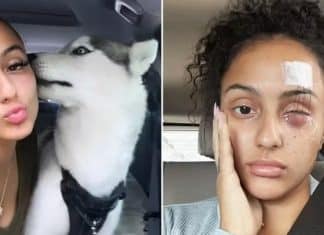 Jovem sai para passear com seu cão e tem um olho removido; entenda o que aconteceu