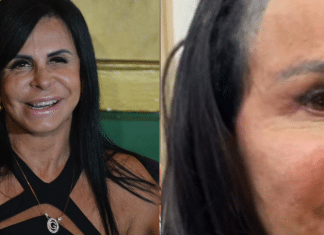 Veja como ficou a Gretchen após inserção de prótese capilar