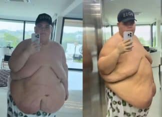 De 349kg para 250kg: Após perder peso drasticamente, Gordão da XJ passa mal e revela detalhes do susto no hospital