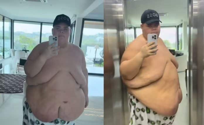 capa De 349kg para 250kg: Após perder peso drasticamente, Gordão da XJ passa mal e revela detalhes do susto no hospital