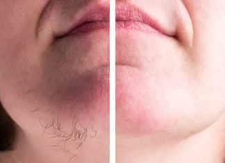 Saiba o que significa ter pelos crescendo no queixo (e quando se preocupar)