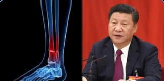 A China inventou uma nova ‘cola para ossos’ que repara fraturas em 3 minutos, sem necessidade de cirurgia ou placas de metal