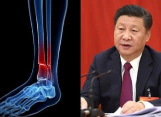 A China inventou uma nova ‘cola para ossos’ que repara fraturas em 3 minutos, sem necessidade de cirurgia ou placas de metal