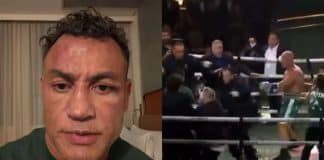 Internado em Salvador, Popó atualiza estado de saúde e detalhes chamam atenção dos fãs