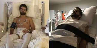 Cientistas do Brasil criam remédio à base de proteína da placenta que devolve movimentos a pessoas tetraplégicas