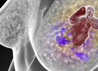 ‘Três aplicações e o tumor sumiu’: molécula de Stanford mostra resultados inéditos contra o câncer