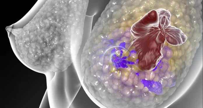 ‘Três aplicações e o tumor sumiu’: molécula de Stanford mostra resultados inéditos contra o câncer