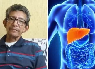 Caso raro em SP: Quais as chances de receber um transplante de órgão com câncer no SUS?