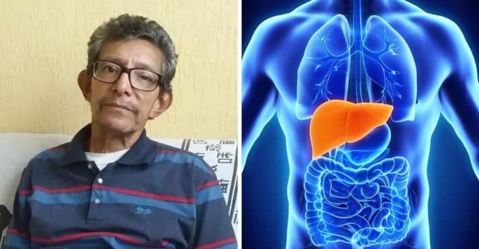 Caso raro em SP: Quais as chances de receber um transplante de órgão com câncer no SUS?