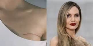 Angelina Jolie mostra cicatrizes de mastectomia preventiva para alertar mulheres sobre câncer de mama