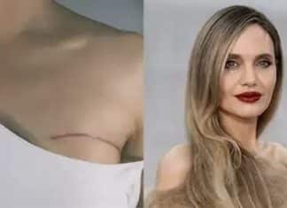 Angelina Jolie mostra cicatrizes de mastectomia preventiva para alertar mulheres sobre câncer de mama