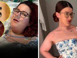 cirurgia contra o cancer tatuagem do braço na língua