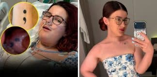 Ela acordou de uma cirurgia contra o câncer e percebeu algo bizarro: a tatuagem do braço estava na língua