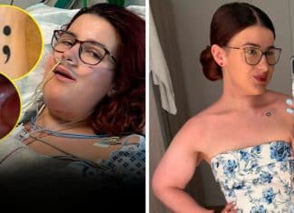 Ela acordou de uma cirurgia contra o câncer e percebeu algo bizarro: a tatuagem do braço estava na língua