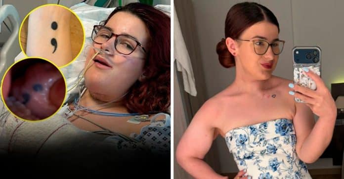 Ela acordou de uma cirurgia contra o câncer e percebeu algo bizarro: a tatuagem do braço estava na língua