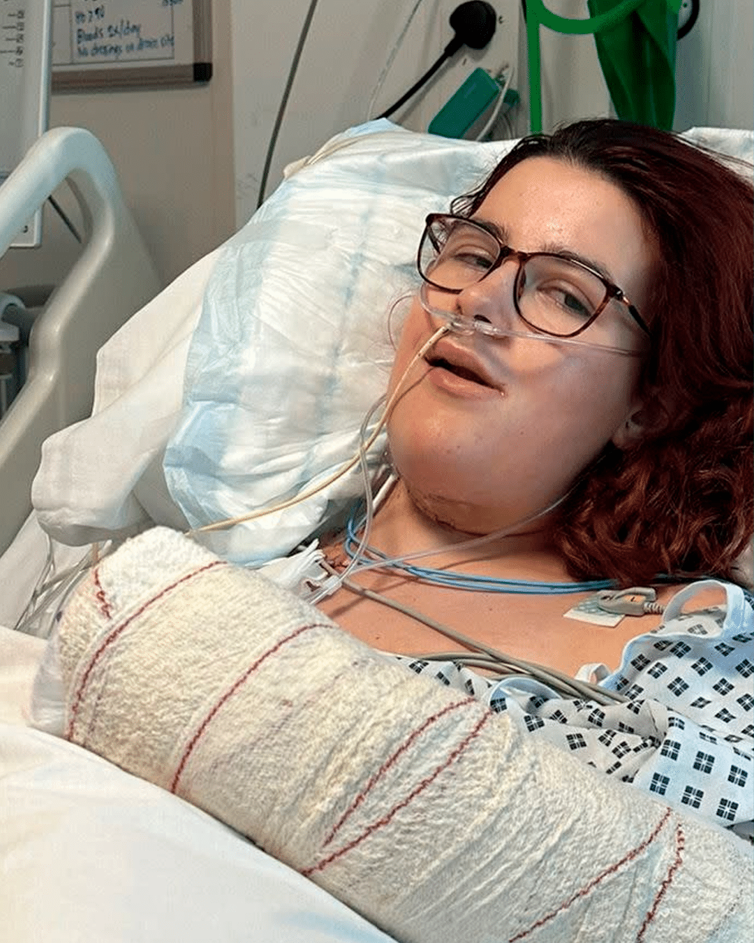 contioutra.com - Ela acordou de uma cirurgia contra o c&acirc;ncer e percebeu algo bizarro: a tatuagem do bra&ccedil;o estava na l&iacute;ngua