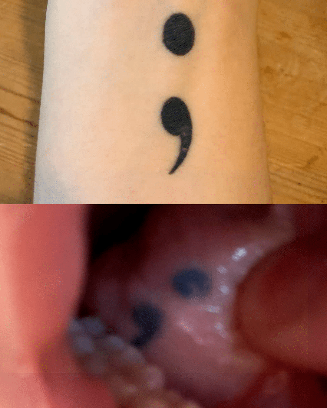 contioutra.com - Ela acordou de uma cirurgia contra o c&acirc;ncer e percebeu algo bizarro: a tatuagem do bra&ccedil;o estava na l&iacute;ngua