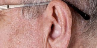 Médico revela: esse vinco na orelha pode estar ligado ao risco silencioso de infarto precoce