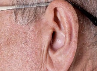 Médico revela: esse vinco na orelha pode estar ligado ao risco silencioso de infarto precoce