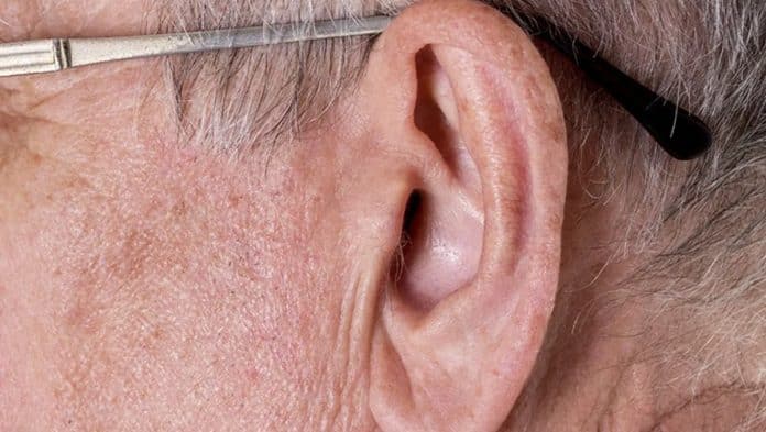 Médico revela: esse vinco na orelha pode estar ligado ao risco silencioso de infarto precoce