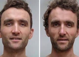 Gêmeos idênticos: Um é vegano, o outro é carnívoro – veja a diferença que isso causou no corpo deles após 5 anos