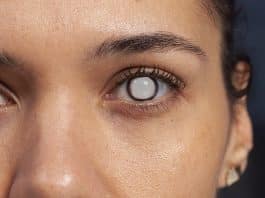 O que médicos já descobriram ao investigar perda de visão em usuárias de Ozempic e Mounjaro