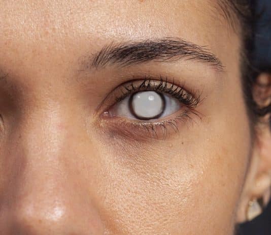 O que médicos já descobriram ao investigar perda de visão em usuárias de Ozempic e Mounjaro