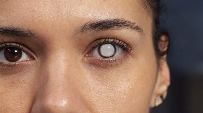 O que médicos já descobriram ao investigar perda de visão em usuárias de Ozempic e Mounjaro