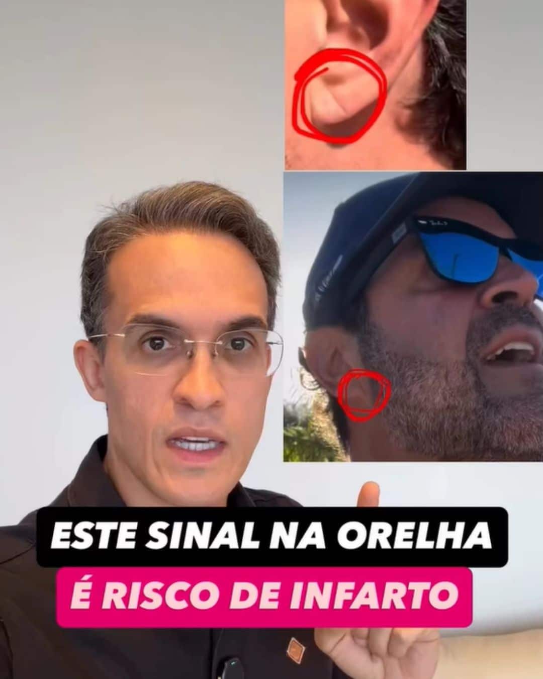 contioutra.com - M&eacute;dico revela: esse vinco na orelha pode estar ligado ao risco silencioso de infarto precoce