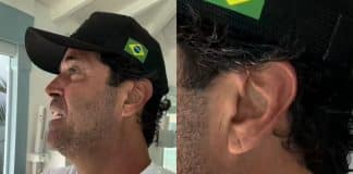 Um detalhe na orelha pode indicar risco cardíaco? O sinal que voltou à tona após a morte de Maderite